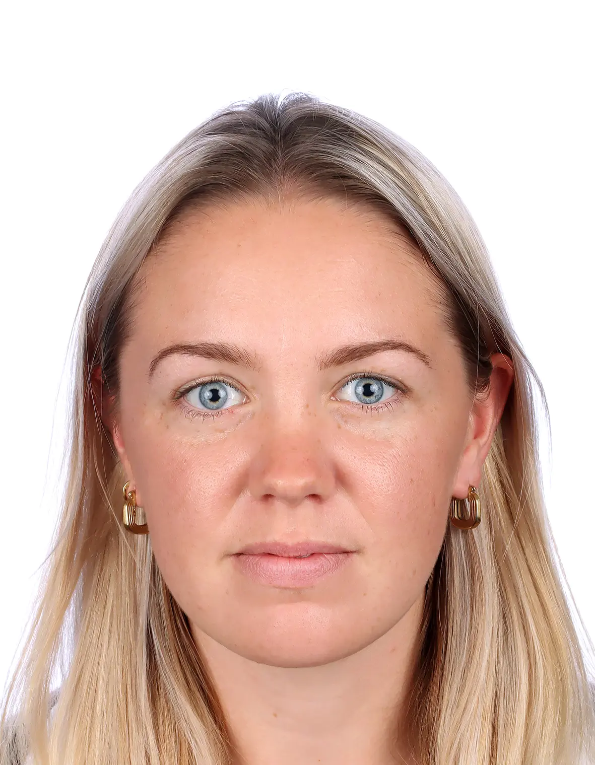 OptimizedImage,,,Optimized